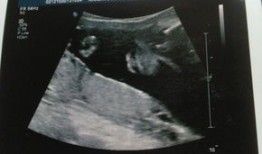 淮北妇幼保健院做nt挂什么科